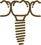 インプラント治療